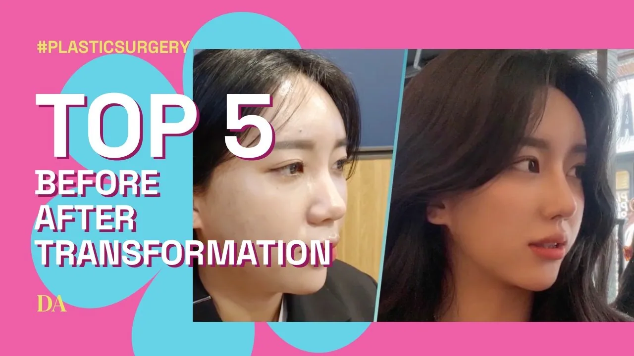 Top 5 Before After Transformation