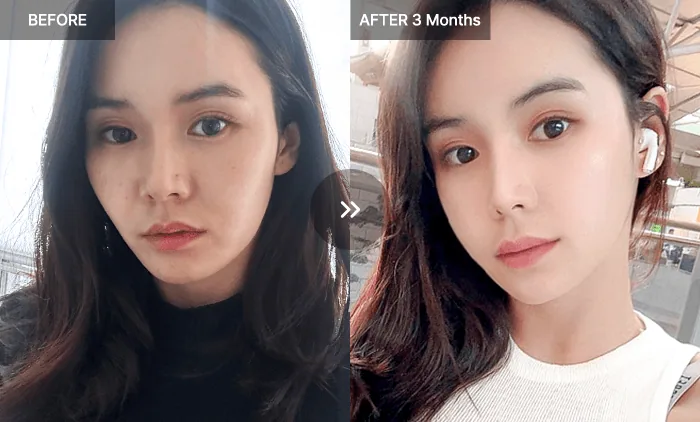 Before and after 3ea-face-fit