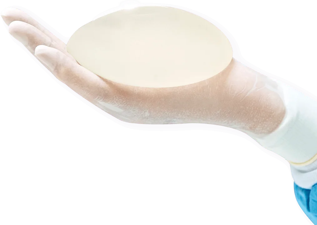 Model ilustrasi Implant Removal