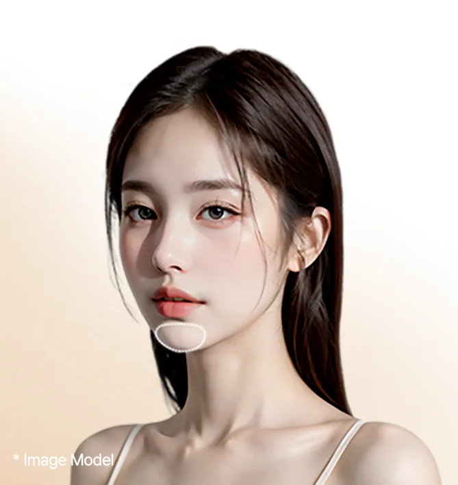 Chin implants