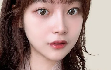 Actual model 2 months after nostril reduction surgery