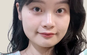 Actual model before nostril reduction surgery