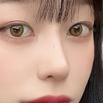 Nose type 5 after