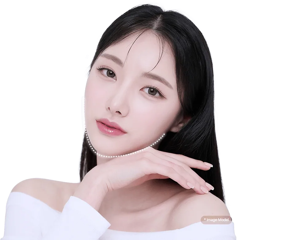 Square jaw surgery model